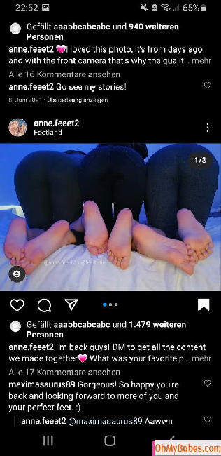 Anne.feeet02 OnlyFans leaked photo #3 - OhMyBabes