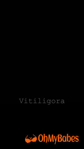 Vitiligora OnlyFans leaked video #31 - OhMyBabes